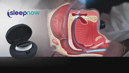 Ems Teknolojisi Akıllı Horlama Cihazı